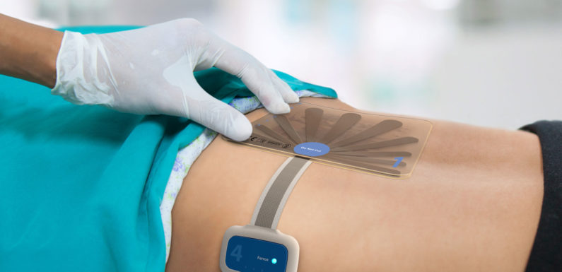 North America the largest Advanced Wound Care Market